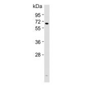 Western blot testing of human HACAT cell lysate with Cyclooxygenase 2 antibody. Predicted molecular weight ~69 kDa.