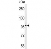 Western blot testing of human Ramos cell lysate with Retinal guanylyl cyclase 1 antibody. Predicted molecular weight ~120 kDa.