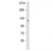 Western blot testing of rat eyeball tissue lysate with Retinal guanylyl cyclase 1 antibody. Predicted molecular weight ~120 kDa.