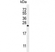 Western blot testing of human A549 cell lysate with Sorting nexin-24 antibody. Predicted molecular weight ~19 kDa.