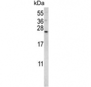 Western blot testing of mouse NIH 3T3 cell lysate with Sorting nexin-24 antibody. Predicted molecular weight ~19 kDa.