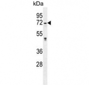Western blot testing of human MCF7 cell lysate with GALNS antibody. Predicted molecular weight ~58 kDa.