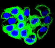 Immunofluorescent staining of human MCF7 cells with GALNS antibody (green) and DAPI nuclear stain (blue).