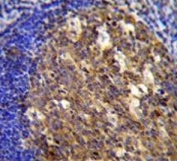 IHC testing of FFPE human tonsil tissue with Twinfilin 2 antibody. HIER: steam section in pH6 citrate buffer for 20 min and allow to cool prior to staining.