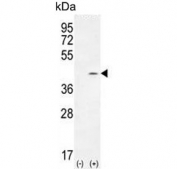 Western blot testing of 1) non-transfected and 2) transfected 293 cell lysate with Twinfilin 2 antibody. Predicted molecular weight ~39 kDa.