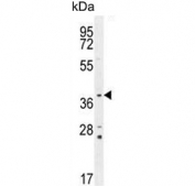 Western blot testing of mouse lung lysate with Twinfilin 2 antibody. Predicted molecular weight ~39 kDa.