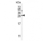 Western blot testing of human MDA-MB-231 cell lysate with Betacellulin antibody. Expected molecular weight: 20-40 kDa depending on glycosylation level.