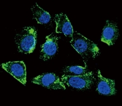 Immunofluorescent staining of human MDA-MB-231 cells with Betacellulin antibody (green) and DAPI nuclear stain (blue).