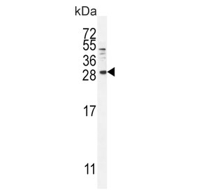 Western blot testing of human MDA-MB-231 cell lysate with Betacellulin antibody. Expected molecular weight: 20-40 kDa depending on glycosylation level.