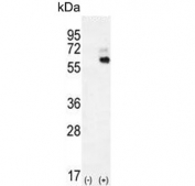 Western blot testing of 1) non-transfected and 2) transfected 293 cell lysate with KNG1 antibody. Predicted molecular weight ~72 kDa.