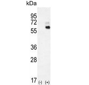 Western blot testing of 1) non-transfected and 2) transfected 293 cell lysate with KNG1 antibody. Predicted molecular weight ~72 kDa.
