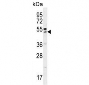 Western blot testing of human MCF7 cell lysate with QTRTD1 antibody. Predicted molecular weight ~47 kDa.