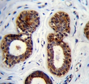 IHC testing of FFPE human breast tissue with QTRTD1 antibody. HIER: steam section in pH6 citrate buffer for 20 min and allow to cool prior to staining.