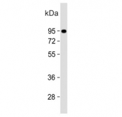 Western blot testing of human ZR-75-1 cell lysate with Slingshot homolog 3 antibody. Predicted molecular weight ~73 kDa, can be observed at 90-95 kDa.