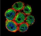 Immunofluorescent staining of human HeLa cells with Slingshot homolog 3 antibody (green), DAPI nuclear stain (blue) and anti-Actin (red).