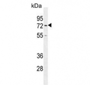Western blot testing of human Ramos cell lysate with CD168 antibody. Expected molecular weight ~72 kDa (cell surface form) and 85-95 kDa (intracellular form).