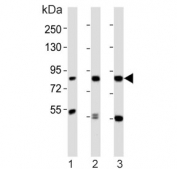 Western blot testing of human 1) K562, 2) LNCaP and 3) HL60 cell lysate with CD168 antibody. Expected molecular weight ~72 kDa (cell surface form) and 85-95 kDa (intracellular form).