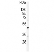 Western blot testing of human A549 cell lysate with CMGA antibody. Expected molecular weight: 50-75 kDa depending on glycosylation level.