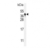 Western blot testing of human A549 cell lysate with BNIP3L antibody. Expected molecular weight: ~38 kDa (monomer), ~76 kDa (homodimer).
