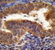 IHC testing of FFPE human uterus tissue with BNIP3L antibody. HIER: steam section in pH6 citrate buffer for 20 min and allow to cool prior to staining.
