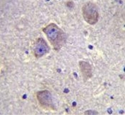 IHC testing of FFPE human brain tissue with WDR27 antibody. HIER: steam section in pH6 citrate buffer for 20 min and allow to cool prior to staining.