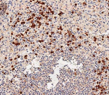 IHC testing of FFPE human spleen tissue with NOD1 antibody. HIER: steam section in pH6 citrate buffer for 20 min and allow to cool prior to staining.