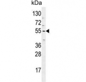 Western blot testing of human NCI-H460 cell lysate with TRIM65 antibody. Predicted molecular weight ~57 kDa.