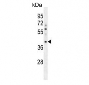 Western blot testing of human A549 cell lysate with MYBPHL antibody. Predicted molecular weight ~38 kDa.