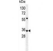 Western blot testing of human A549 cell lysate with SOWAHD antibody. Predicted moleuclar weight ~34 kDa.