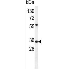 Western blot testing of human A549 cell lysate with SOWAHD antibody. Predicted moleuclar weight ~34 kDa.
