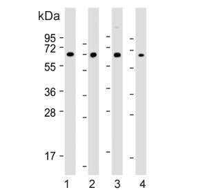 Western blot testing of 1) human SH-SY5Y, 2) human Jurkat, 3) mouse Neuro-2a and 4) mouse C2C12 cell lysate with COL8A2 antibody. Predicted molecular weight ~67 kDa.