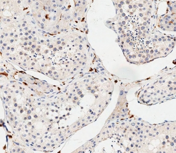 IHC testing of FFPE human testis tissue with COL8A2 antibody. HIER: steam section in pH6 citrate buffer for 20 min and allow to cool prior to staining.
