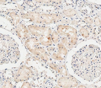 IHC testing of FFPE human kidney tissue with COL8A2 antibody. HIER: steam section in pH6 citrate buffer for 20 min and allow to cool prior to staining.
