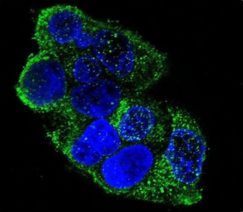 Immunofluorescent staining of human HepG2 cells with COL8A2 antibody (green) and DAPI nuclear stain (blue).