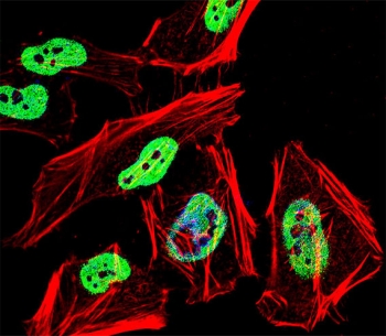 Immunofluorescent staining of fixed and permeabilized human HeLa cells with KAP1 antibody (green), DAPI nuclear stain (blue) and anti-Actin (red).