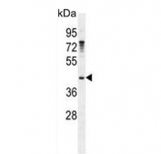 Western blot testing of human NCI-H460 cell lysate with Growth arrest-specific protein 1 antibody. Predicted molecular weight ~36 kDa but may be observed at higher molecular weights due to glycosylation.