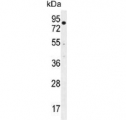 Western blot testing of human ZR-75-1 cell lysate with Beta-TrCP antibody. Predicted molecular weight ~69 kDa.