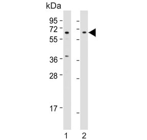 Western blot testing of human 1) HepG2 and 2) HEK293 cell lysate with Beta-TrCP antibody. Predicted molecular weight ~69 kDa.