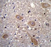 IHC testing of FFPE human brain tissue with Beta-TrCP antibody. HIER: steam section in pH6 citrate buffer for 20 min and allow to cool prior to staining.