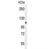 Western blot testing of mouse spleen tissue lysate with PELP1 antibody. Expected molecular weight: 120-160 kDa.