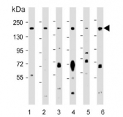Western blot testing of human T-47D, 2) mouse testis, 3) human HeLa, 4) human MCF7, 5) mouse NIH 3T3 and 6) human SW620 cell lysate with PELP1 antibody. Expected molecular weight: 120-160 kDa.