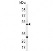 Western blot testing of mouse spleen tissue lysate with TBC1D13 antibody. Predicted molecular weight ~47 kDa.