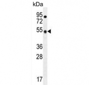 Western blot testing of human CCRF-CEM cell lysate with TBC1D13 antibody. Predicted molecular weight ~47 kDa.
