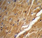 IHC testing of FFPE mouse heart tissue with TBC1D13 antibody. HIER: steam section in pH6 citrate buffer for 20 min and allow to cool prior to staining.