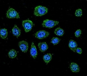 Immunofluorescent staining of human A549 cells with Embryonic polyadenylate-binding protein 2 antibody (green) and DAPI nuclear stain (blue).