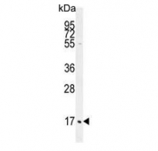 Western blot testing of human HL60 cell lysate with C1QC antibody. Predicted molecular weight ~26 kDa.