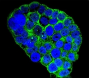 Immunofluorescent staining of human WiDr cells with C1QC antibody (green) and DAPI nuclear stain (blue).
