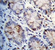 IHC testing of FFPE human rectum tissue with C1QC antibody. HIER: steam section in pH6 citrate buffer for 20 min and allow to cool prior to staining.