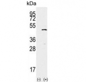 Western blot testing of 1) non-transfected and 2) transfected 293 cell lysate with SETD7 antibody. Predicted molecular weight ~41 kDa, commonly observed at 40-60 kDa.