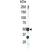 Western blot testing of mouse brain tissue lysate with SETD7 antibody. Predicted molecular weight ~41 kDa, commonly observed at 40-60 kDa.